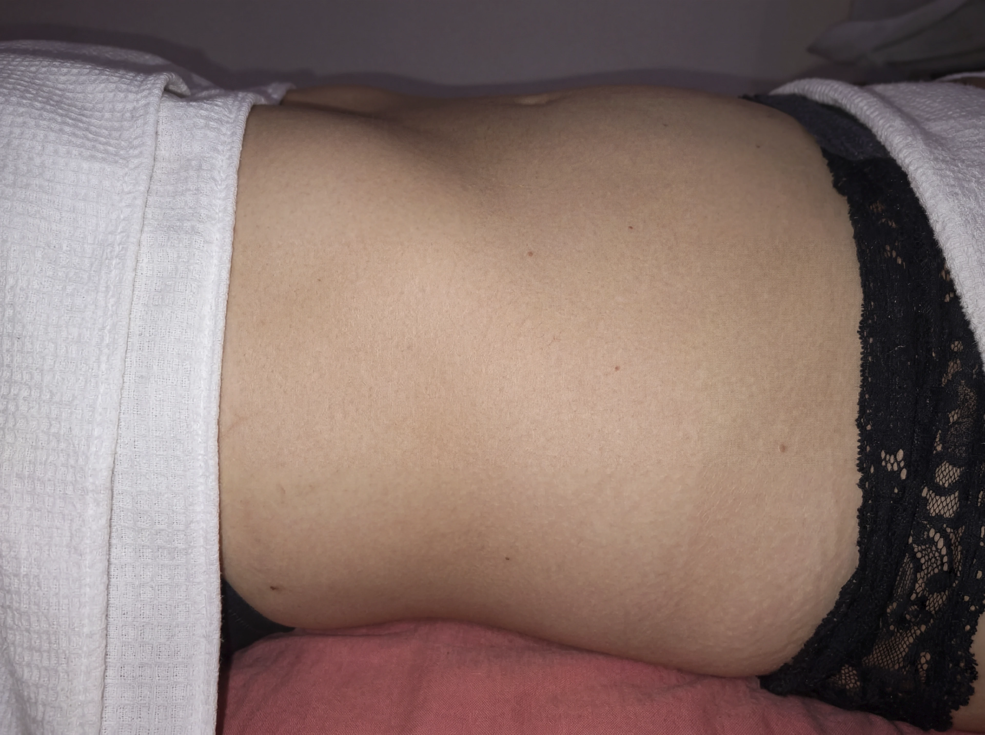 Transformação ANTES