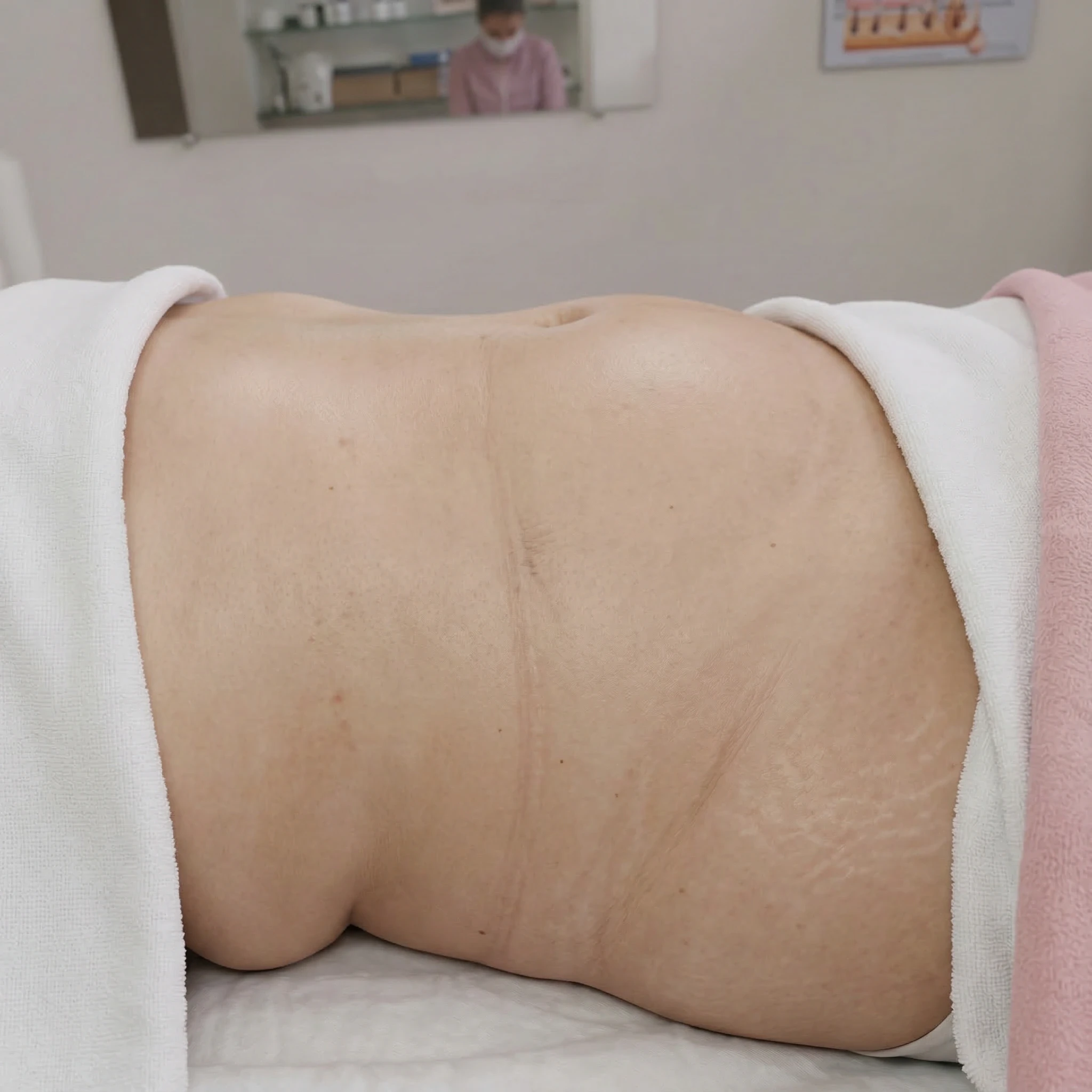 Transformação ANTES